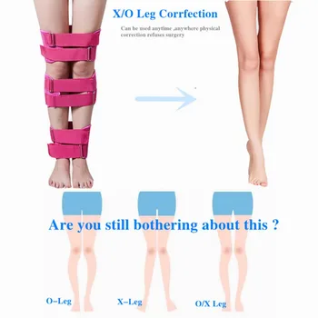 Prijenosni korektor za noge O/ X-Leg, pojas za ispravljanje valgus deformacija potkoljenice, Zavoj za korekciju držanja, Siguran, Udoban za odrasle i djecu